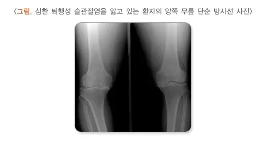 퇴행슬관절염 진단 및 검사 설명 이미지 1