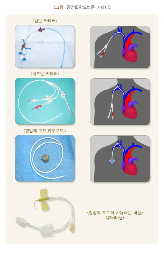 항암화학요법(항암제치료) 치료 관련 주의사항 설명 이미지 1
