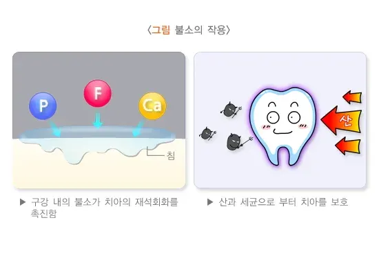 불소도포 건강에 미치는 영향 설명 이미지 1