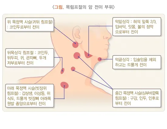 경부 종괴 종류 설명 이미지 1