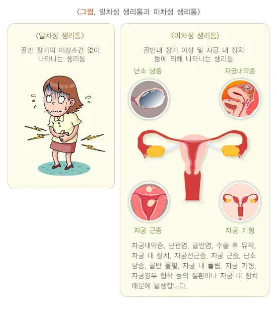 생리통 증상 설명 이미지 1