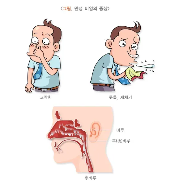 만성비염 증상 설명 이미지 1