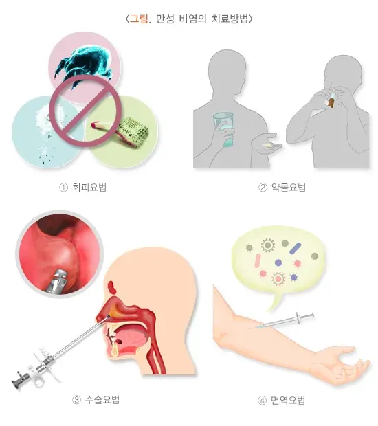 만성비염 치료 설명 이미지 1
