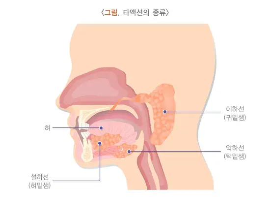 구강건조증 정의 설명 이미지 1