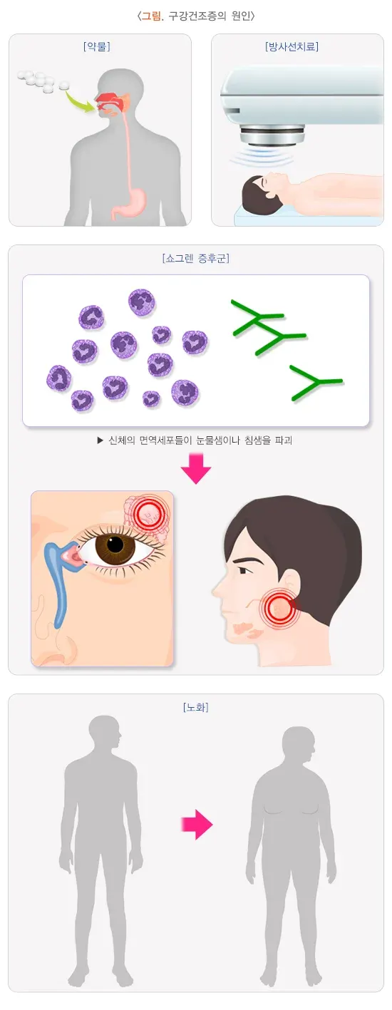 구강건조증 원인 설명 이미지 1