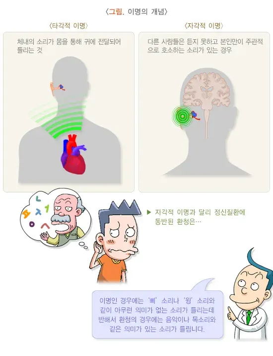 이명 정의 설명 이미지 1