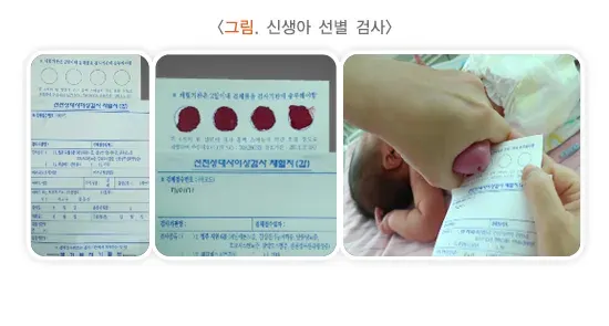 선천갑상샘저하증 진단 및 검사 설명 이미지 3