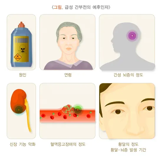 급성 간부전 경과 및 예후 설명 이미지 1