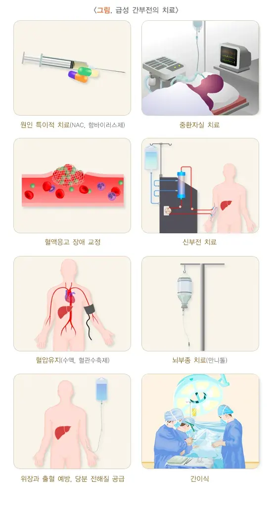 급성 간부전 치료 설명 이미지 1
