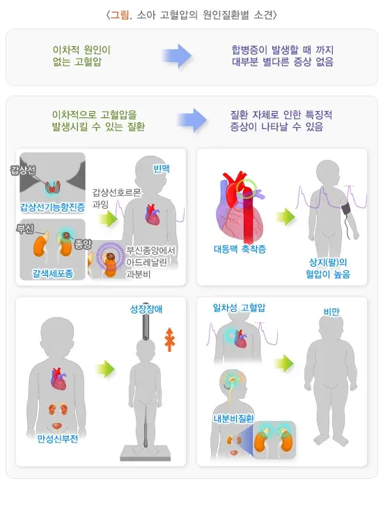 소아청소년기고혈압 증상 설명 이미지 1