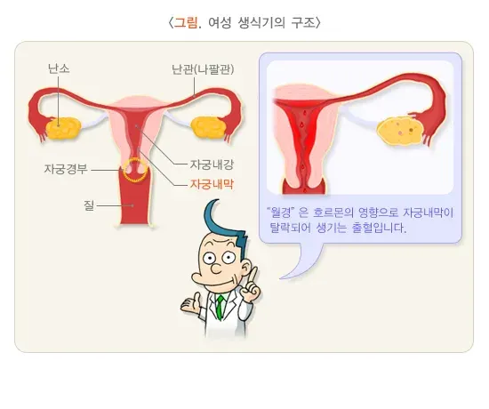 자궁내막증 정의 설명 이미지 1