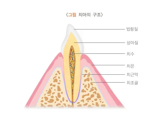 치통 및 만성 통증(치통) 종류 설명 이미지 1