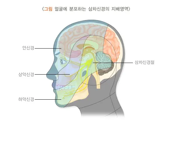 치통 및 만성 통증(구강안면부의 만성 통증) 종류 설명 이미지 1