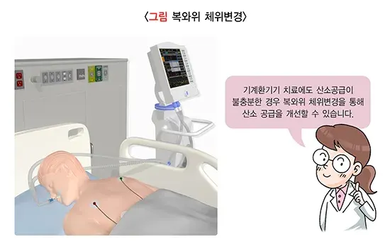 급성호흡곤란증후군 비약물 치료 설명 이미지 2