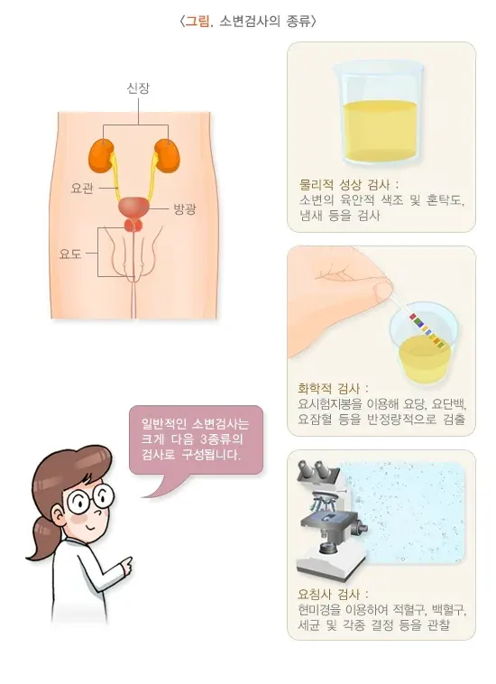 소변검사 검사 적응증 및 금기증 설명 이미지 1