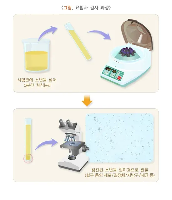 소변검사 검사 장비 설명 이미지 1