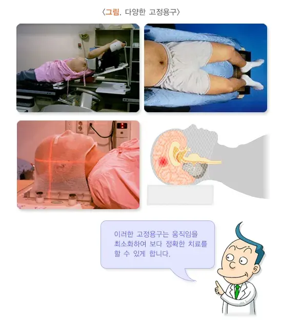 방사선치료 치료 관련 검사 설명 이미지 3