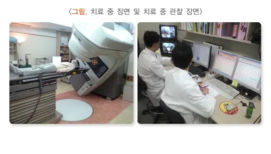 방사선치료 치료 관련 검사 설명 이미지 2