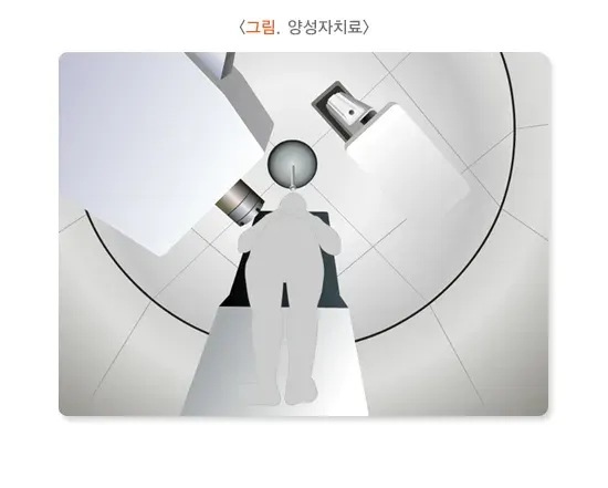 방사선치료 치료 방법 설명 이미지 8