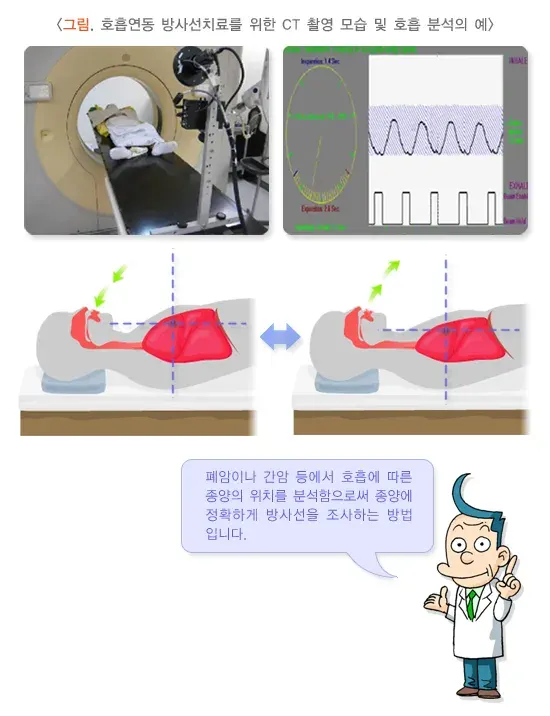방사선치료 치료 방법 설명 이미지 4