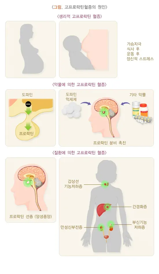 유루증 원인 설명 이미지 1