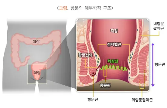 치핵 병태생리 설명 이미지 1
