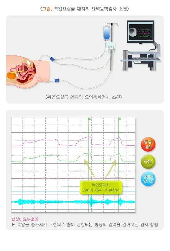 요실금 진단 및 검사 설명 이미지 2
