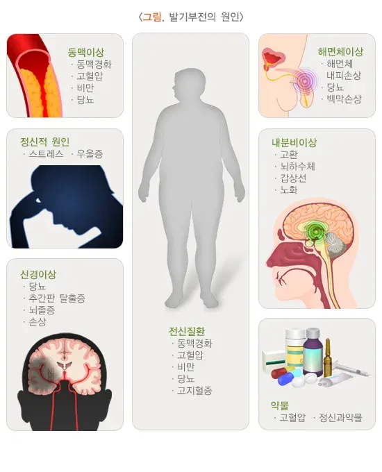 발기부전 종류 설명 이미지 1