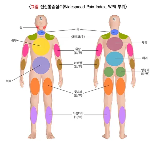 섬유근육통 진단 및 검사 설명 이미지 1