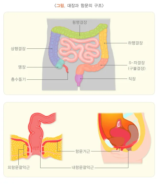변비 원인 설명 이미지 1