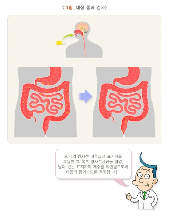 변비 진단 및 검사 설명 이미지 1