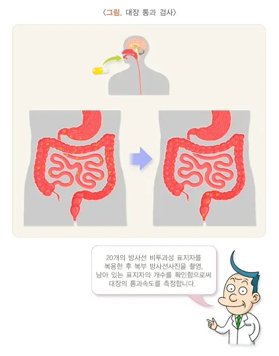 변비 진단 및 검사 설명 이미지 1