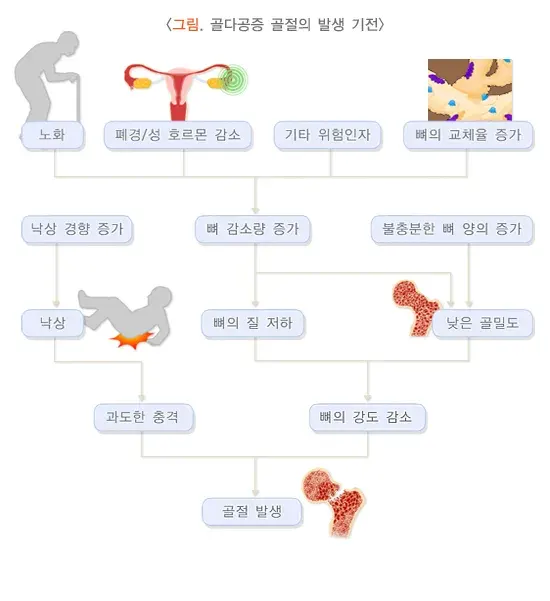 골다공증 연관 증상 설명 이미지 2