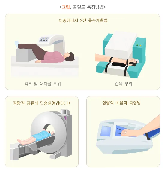 골다공증 진단 및 검사 설명 이미지 1