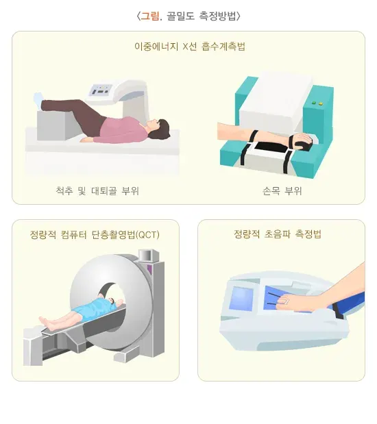 골다공증 진단 및 검사 설명 이미지 1