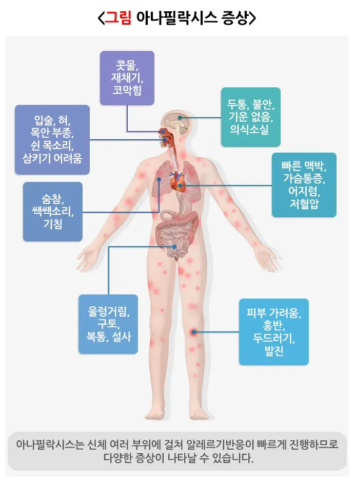아나필락시스 연관 증상 설명 이미지 1