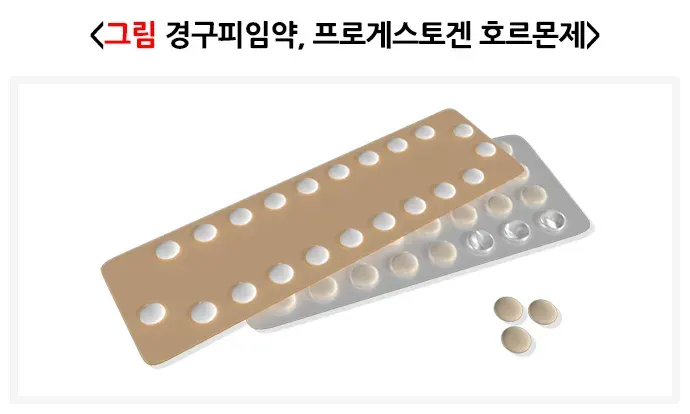 다낭성난소증후군 치료 설명 이미지 2