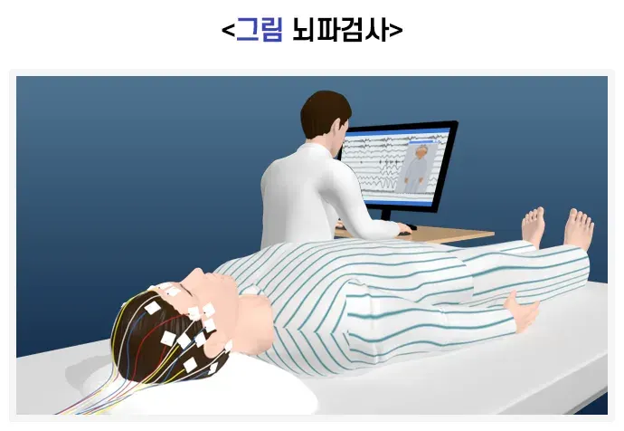 뇌전증 진단 및 검사 설명 이미지 1