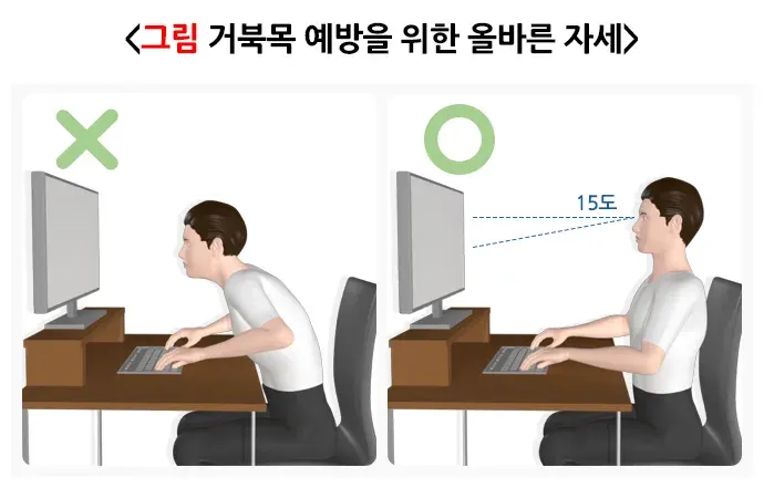 일자목(거북목)증후군 위험요인 및 예방 설명 이미지 1
