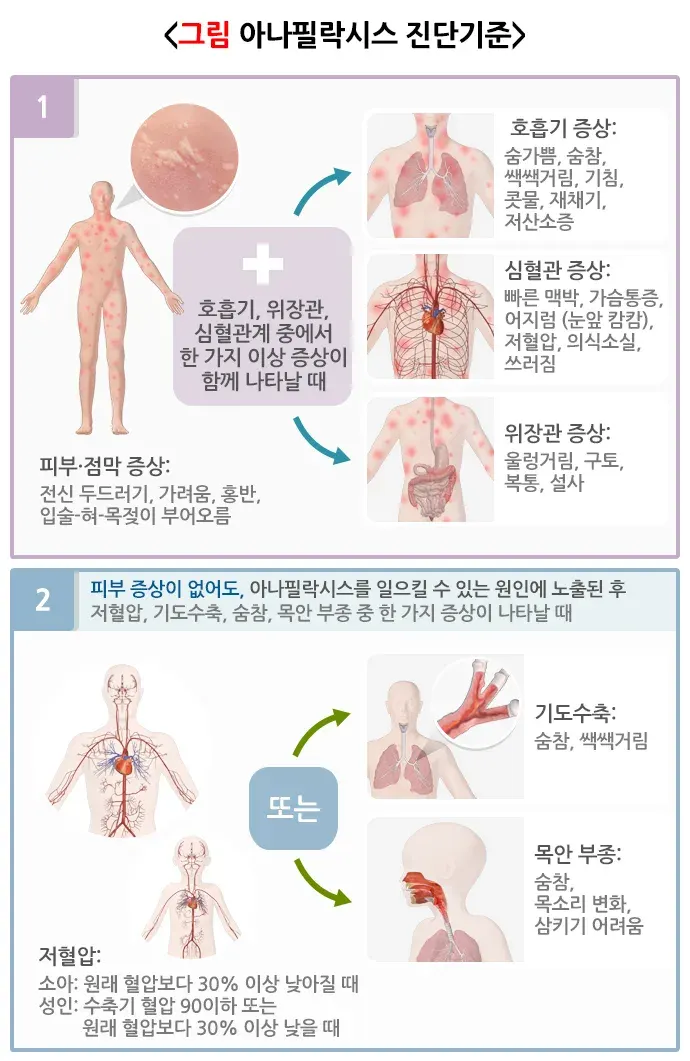 아나필락시스 진단 및 검사 설명 이미지 1