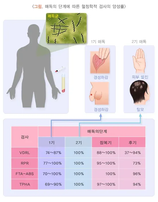 감염질환의 혈청검사 검사 결과 해석 설명 이미지 4