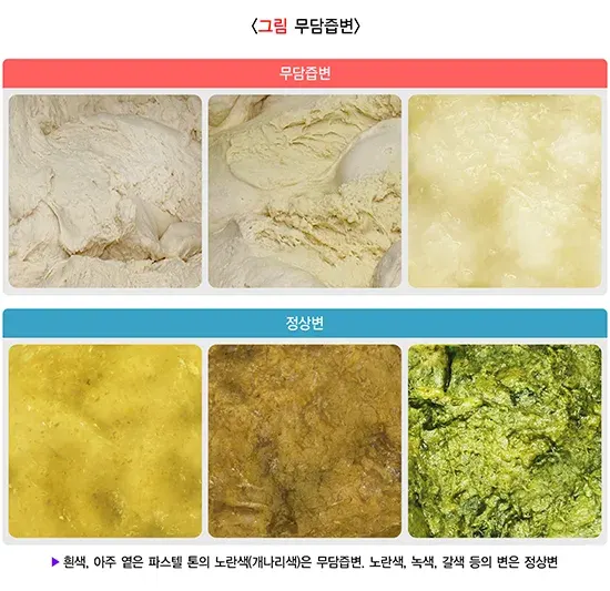 신생아 황달 진단 및 검사 설명 이미지 3