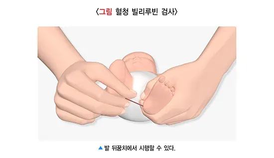 신생아 황달 진단 및 검사 설명 이미지 4