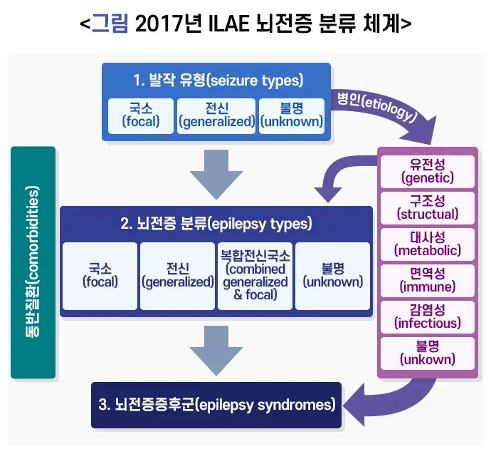 뇌전증 종류 설명 이미지 1