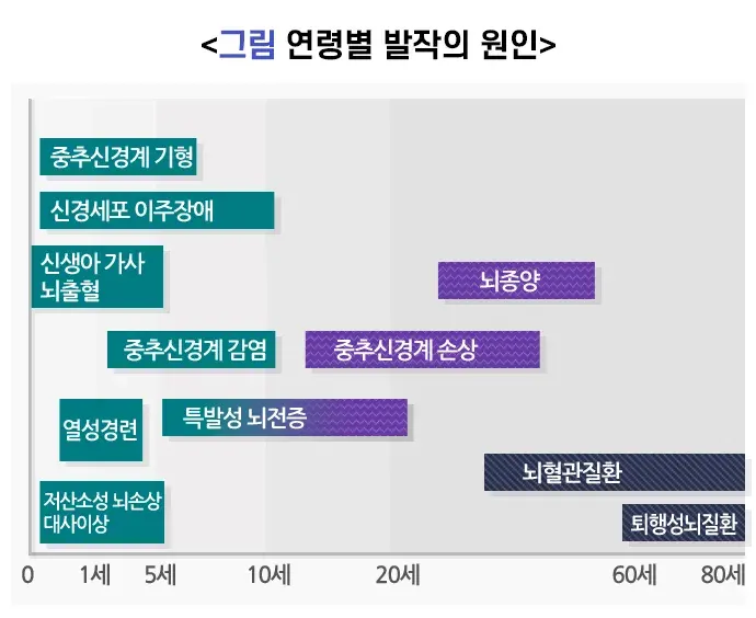 뇌전증 종류 설명 이미지 2