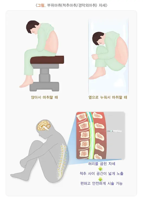 부위마취 치료 방법 설명 이미지 1