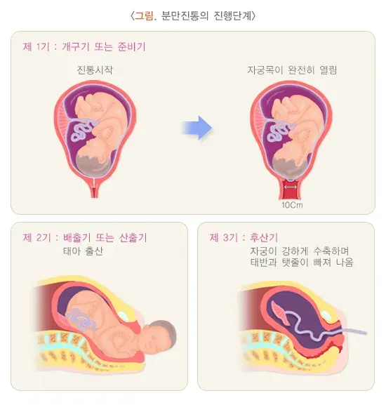 자연분만과정 경과 및 예후 설명 이미지 3