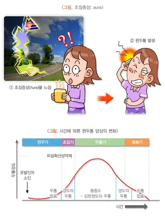 편두통 경과 및 예후 설명 이미지 1