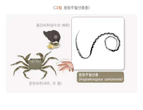 광동주혈선충증 원인 및 감염경로 설명 이미지 1