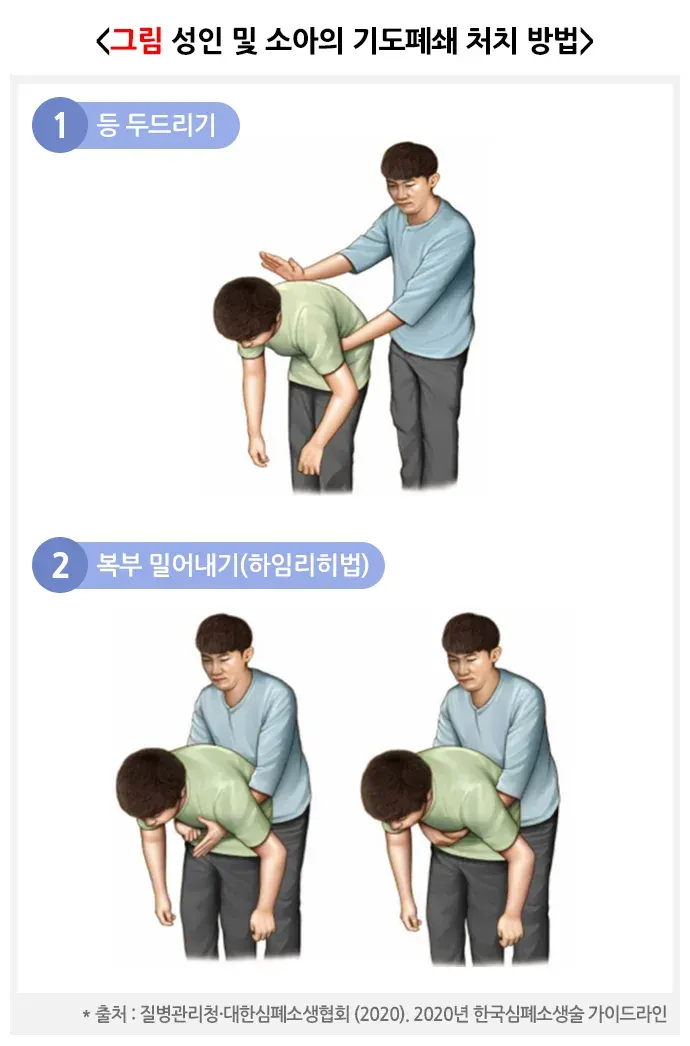 심폐소생술(이물질에 의한 기도폐쇄의 처치) 치료 방법 설명 이미지 1